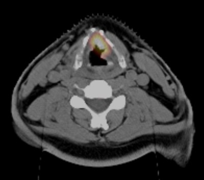 Initial CT scan