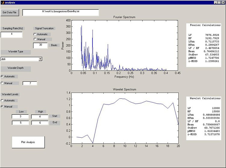 heart rate MATLAB GUI